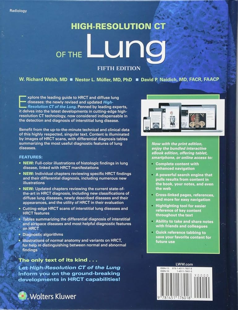 High-Resolution CT of the Lung : W.Richard Webb, Nestor L